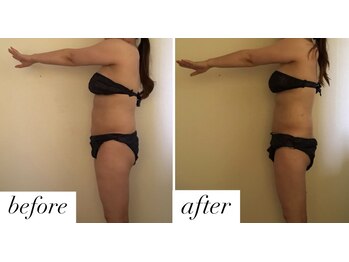 ベルシア(Bellucia)/