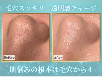 リメイク 広尾(REMAKE)