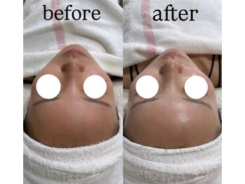 アールビューティー 東新宿店(R’Beauty)/クリスティーナ/アンストレス