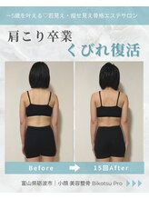 ビコツプロ(Bikotsu Pro)/肩こり卒業くびれ復活