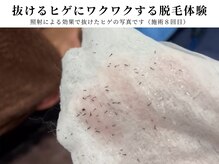 ボス 津店(BOSS)の雰囲気（施術後に抜けるヒゲ#脱毛#メンズ脱毛#ヒゲ脱毛#学割U24#全身脱毛）