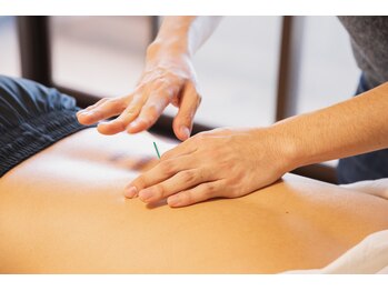 きよらか鍼灸接骨院/整体+リカバリー電流+鍼灸施術