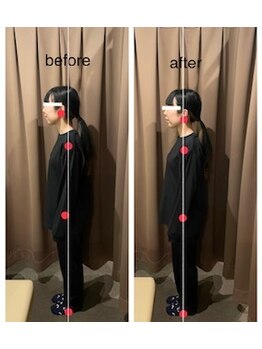 アイリー(Irie)/姿勢矯正