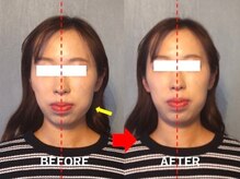 アトラス/初回のお客様のBefore＆after