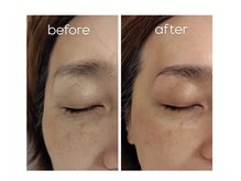 エクラ(eclat)/ハリウッドブロウリフト