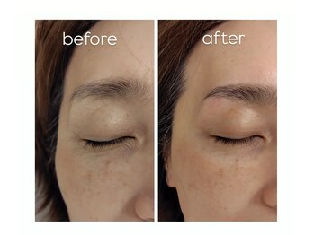 エクラ(eclat)/ハリウッドブロウリフト