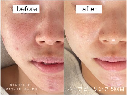 リシェル(Richelle)の写真