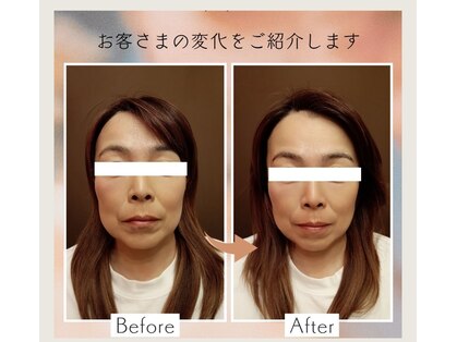 ソヨリプラス(Soyory Plus)の写真