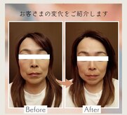 ソヨリプラス(Soyory Plus)