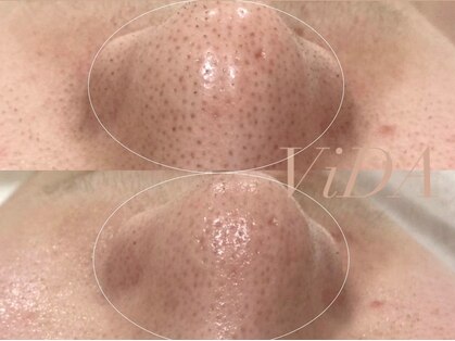 ヴィーダ 渋谷松濤(ViDA)の写真