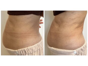 ポノーラ(Ponola)/インドエステ