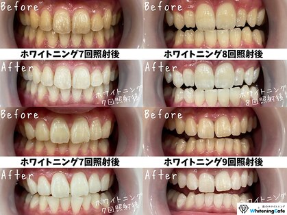 ホワイトニングカフェ 北九州小倉店(WhiteningCafe)の写真
