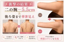 バービーグロウ 恵比寿(Barbie Glow)