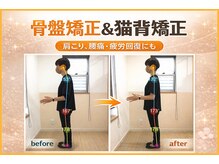 ハンズ鍼灸接骨院小牧院 美容整体ハンズ(美容整体hands)の雰囲気（身体のゆがみを整えて不調を原因から回復！肩こり、腰痛にも◎）