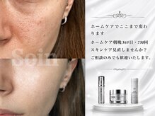 ソアン(Soin)/スキンケアで変わる