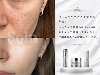 ソアン(Soin)/スキンケアで変わる