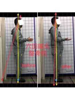 穴田鍼灸整骨院/整体・骨盤・ねこぜ・まき肩矯正