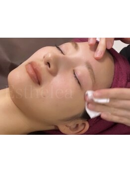 小顔になりたい