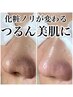 【毛穴詰まり徹底オフ！黒ずみ撃退コース】 メイク映えするつるん肌に！
