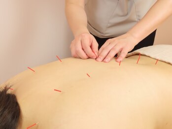 ミロクの里鍼灸院 東長崎店の写真/＜何をしてもよくならない！！＞自律神経、更年期、女性の悩みなどに◎東洋医学的にお体を判別＆施術☆
