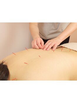 鍼灸施術を受けたい