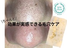 シェノン(Chainon)