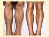 【メンズ足(太もも~足先)脱毛】ハーパン男子に◎初回特別料金♪¥8100→¥5000