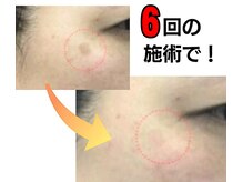 じゅえるの雰囲気(掲載写真は実際の写真ですが、個人差有り)