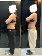 ビオラス 太田藤阿久店/キャビテーション×骨盤矯正