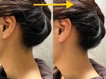 剃らないとソン 横浜店/襟もキレイになります♪