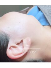 ブラジリアンワックス専門店 アンジー(ANGIE)/もみあげデザイン2