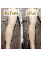 プライベートサロン ヴィヴィアン(Vivian)/キャビマックスの効果(足痩身)