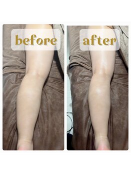 プライベートサロン ヴィヴィアン(Vivian)/キャビマックスの効果(足痩身)