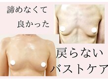 筋膜にアプローチ★バストアップ技術でバストを残してダイエット