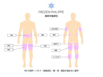 ウナ 福岡店(UNA)/【パーツ表】ケア可能部位