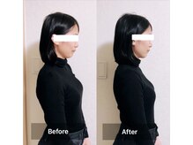 ラニ(Lani)/小顔美人整顔