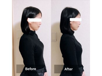 ラニ(Lani)/小顔美人整顔