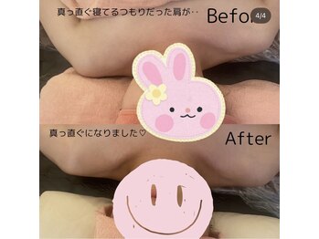 スターリィ スカイ(Starry☆Sky)/before→after