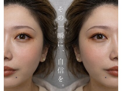 アリイ(Alii)の写真