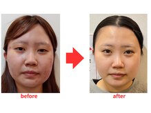 ブプラ 小倉店(BUPURA)/