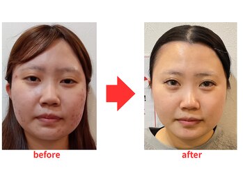 ブプラ 小倉店(BUPURA)/