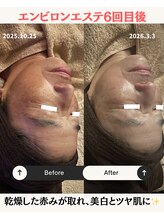 リマイン(Re mine)/肌の引き締め/細胞を活性化