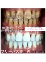 ホワイトニングサロン 福岡博多店
