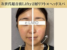 イーラボ 池袋店(e-LABO)/フェイスラインすっきり小顔♪