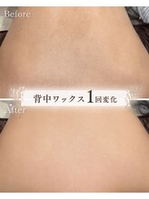 サロンベイア(salon Beia)/背中ワックス1回変化♪