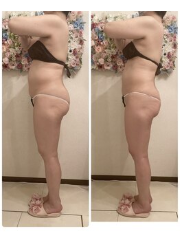 ベルヴィー(Belle vie)/セクシャル美ボディケア120分