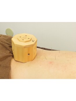 鍼灸施術を受けたい