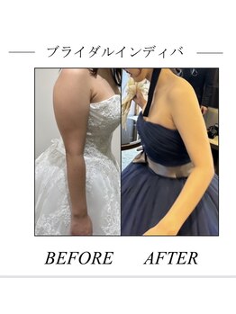 ファミーユ 新宿店/【ブライダルエステ】インディバ