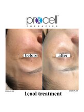 ヒルナム(Heal Nam)/プロセルセラピーズ~フェイス~