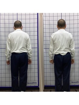 穴田鍼灸整骨院/整体・骨盤・ねこぜ・まき肩矯正